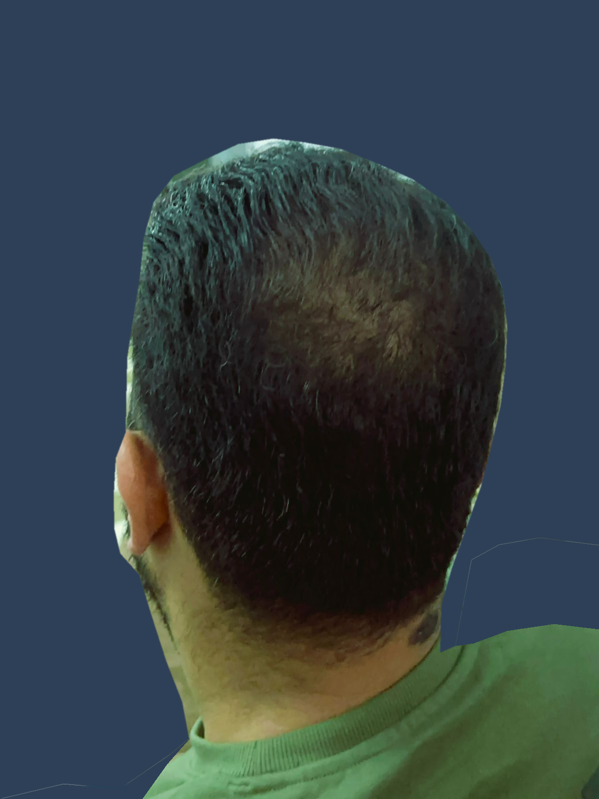 قبل وبعد — منطقة التاج