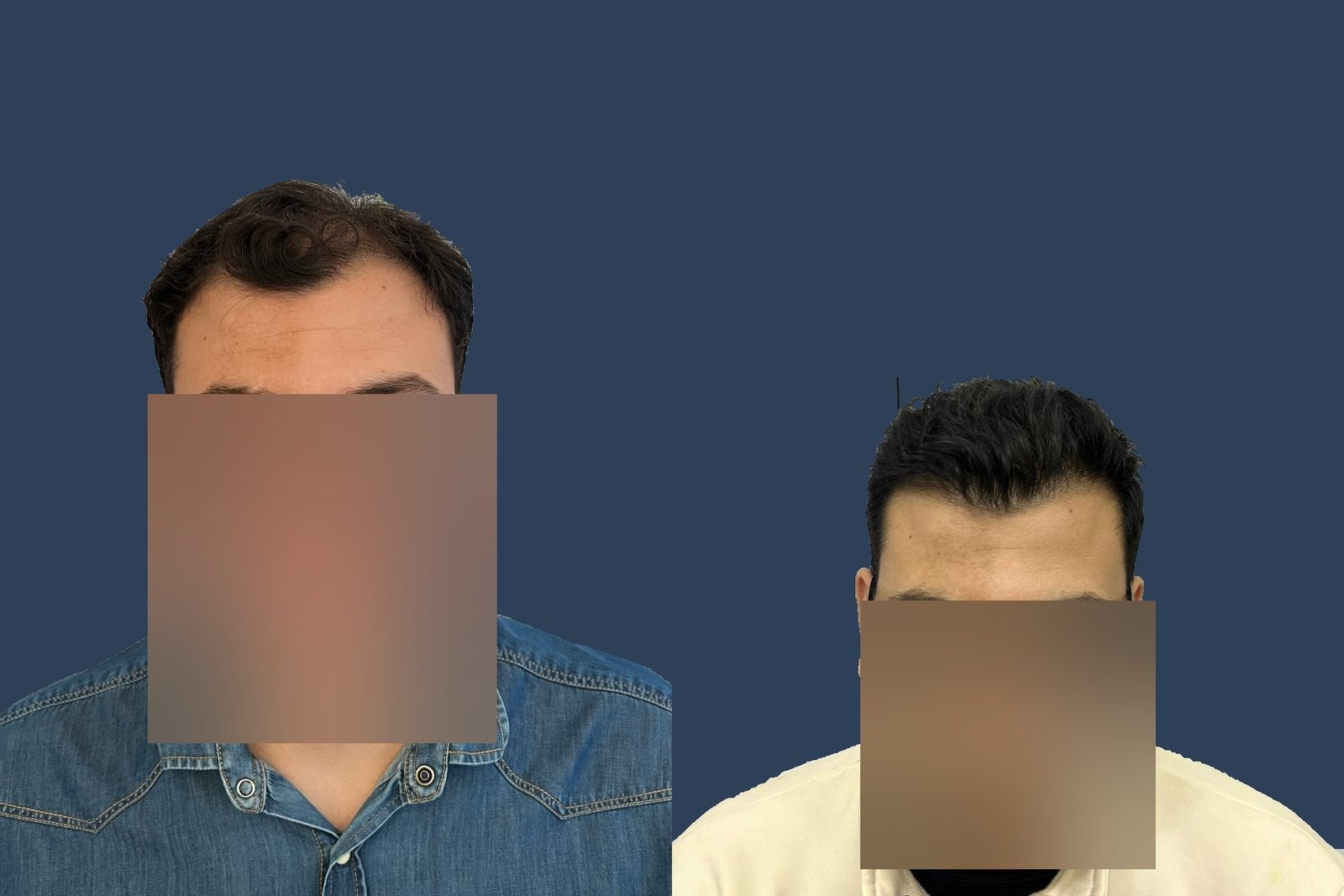 قبل وبعد — مقدمة الشعر