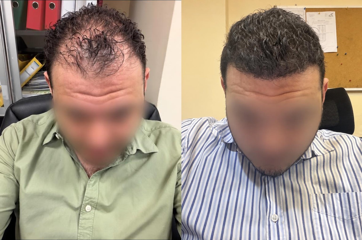 قبل وبعد — كثافة مقدمة الشعر