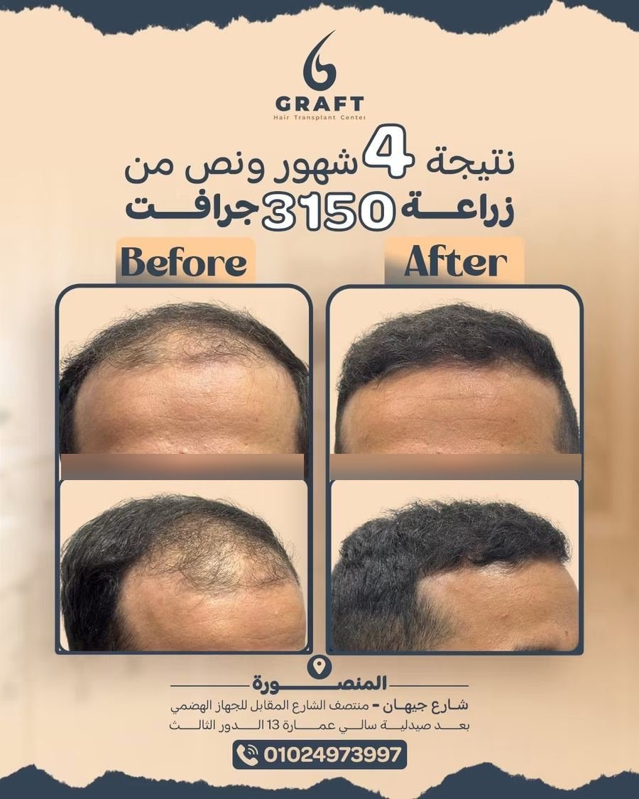 3150 جرافت