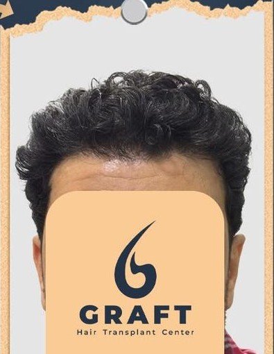 نتيجة طبيعية وواقعية